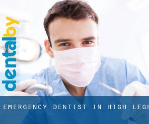 Emergency Dentist in High Legh