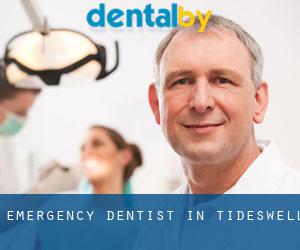 Emergency Dentist in Tideswell