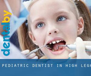 Pediatric Dentist in High Legh