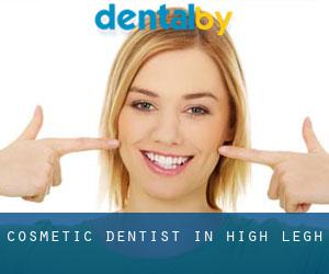 Cosmetic Dentist in High Legh