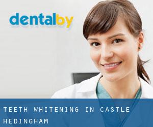 Teeth whitening in Castle Hedingham