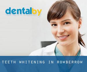 Teeth whitening in Rowberrow